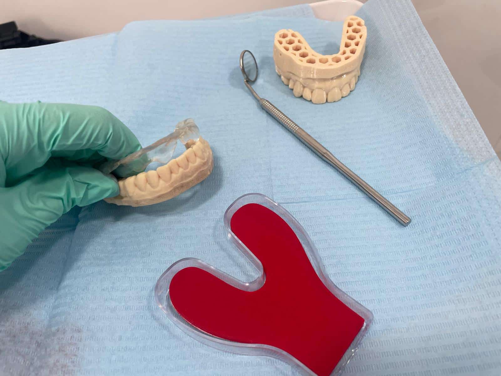 Ce este un „splint” și de ce o gutieră dentară greșită îți poate agrava durerea de maxilar 1 ce este splint