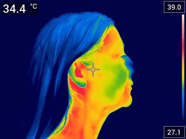 scanari termografie dreapta