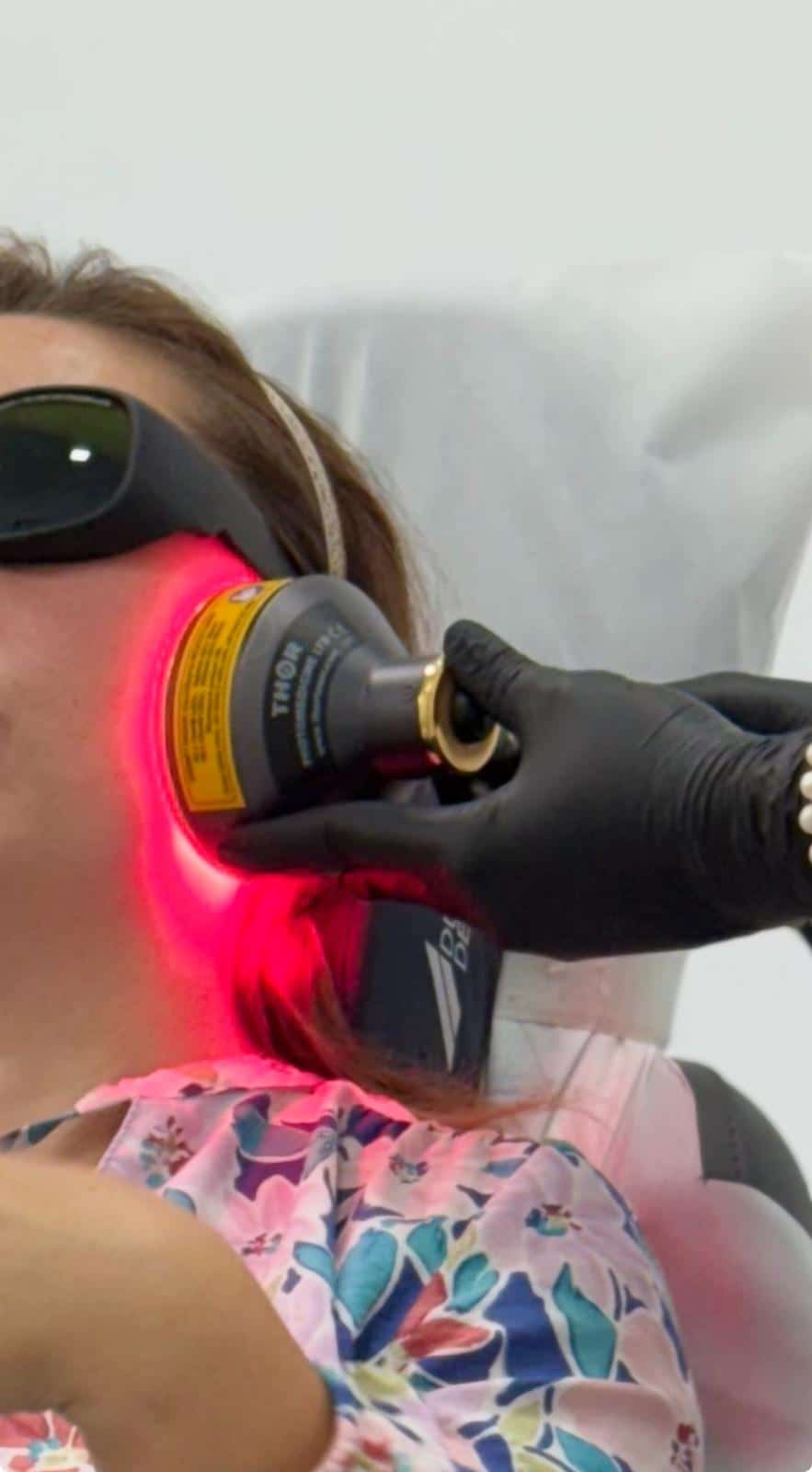 tratament photobiomodulare laser ATM