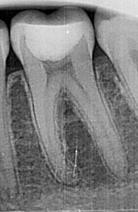 moral inferior cu sase canale