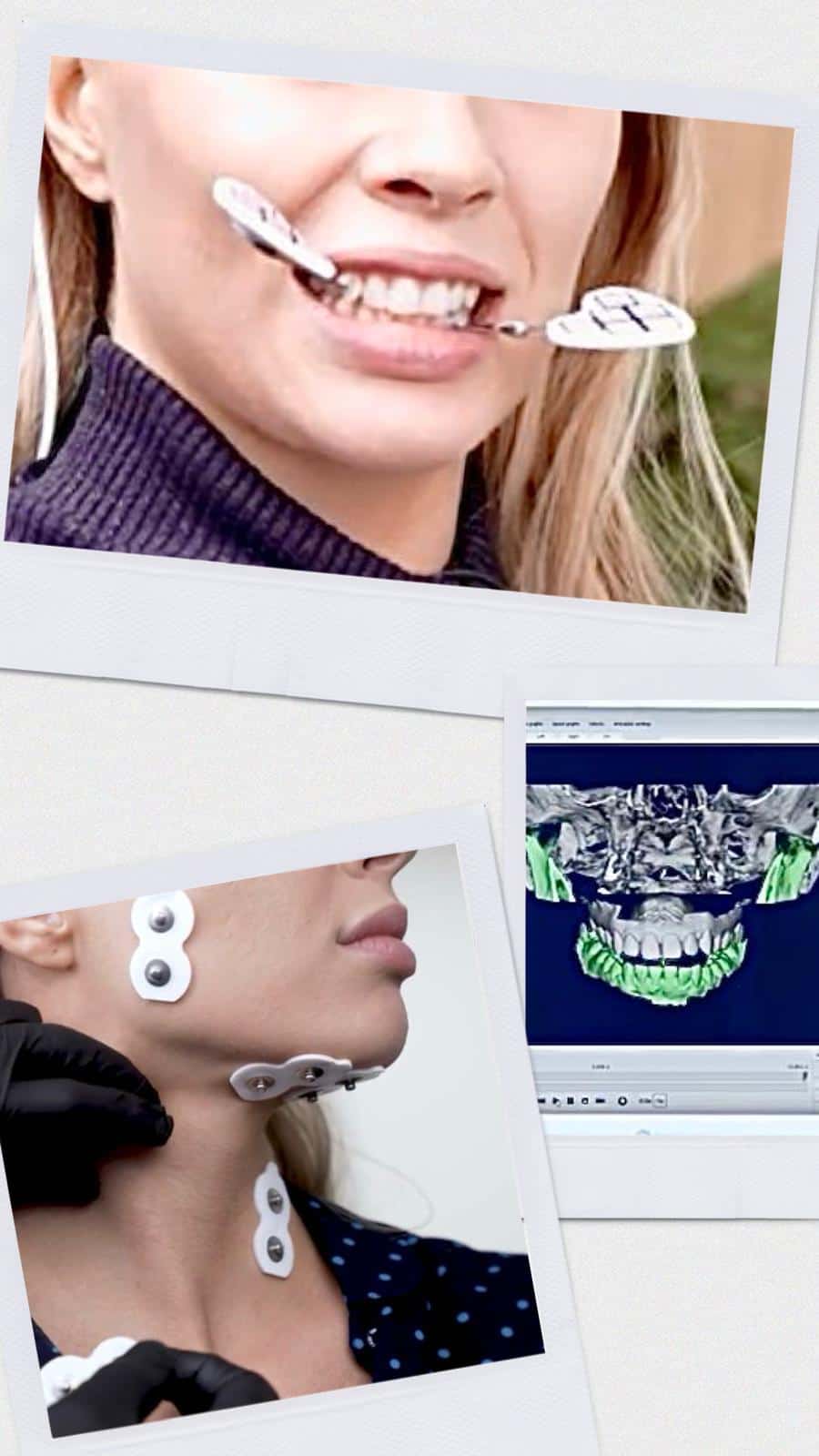 stomatologie functionala ATM