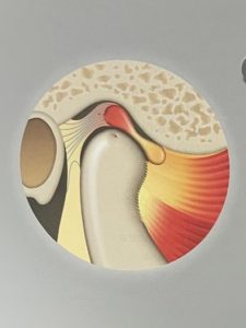 Anatomia articulatiei temporo mandibulare ATM