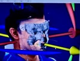 Ce se intampla cand condilul NU se mai misca corect