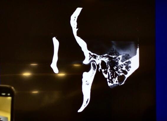 Suprapunerea investigatiilor imagistice