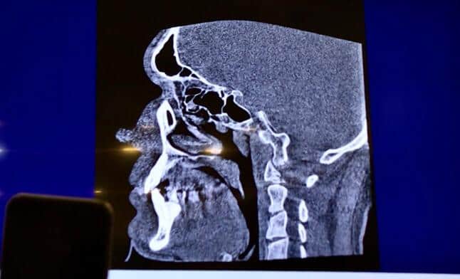 evaluare-functionala-stomagoloice-si-cranio-mandibulare
