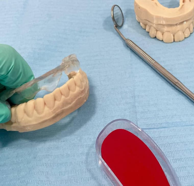 gutiera de stabilizare nocturna