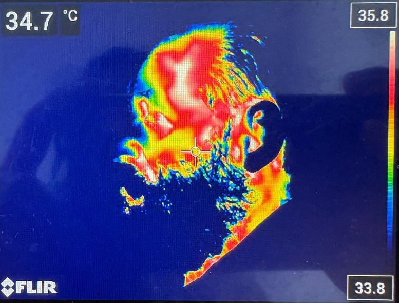 termografie laser faciala 2