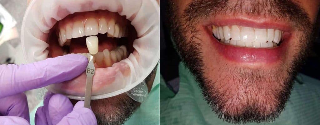 voucher estetica dentara