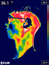 Termografie faciala initiala partea dreapta