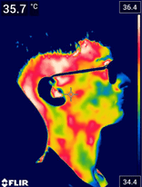 Termografie faciala initiala partea stanga