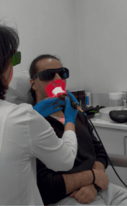 Blog 21 Tratament modern al mucozitei orale cu laser THOR utilizat în cadrul Innovation Medical Center