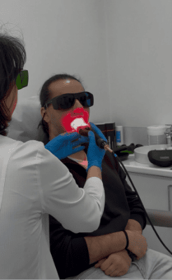 Tratament modern al mucozitei orale cu laser THOR utilizat în cadrul Innovation Medical Center