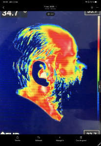 Termografiile facială și axială realizate la Innovation Medical Center