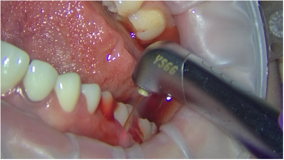 Tissue preservation