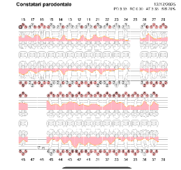 Inainte de tratament