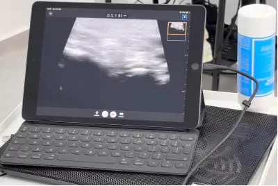 Fiecare metoda raspunde unor intrebari diferite