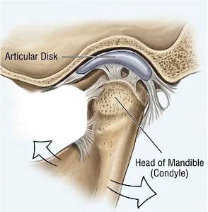 articular dark